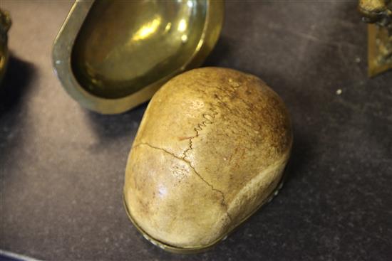 A Tibetan brass mounted human skull kapala, 19th century, 27.5cm